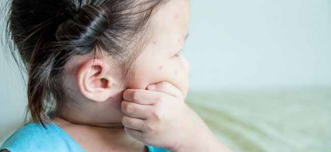 Claves Para Evitar Picaduras De Mosquitos En Niños Y Embarazadas
