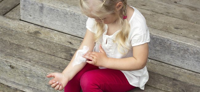 Problemas en la piel de los niños