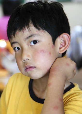 Hipertensión en el Día Mundial de la Salud 2013 Hipertensión en el Día Mundial de la Salud 2013