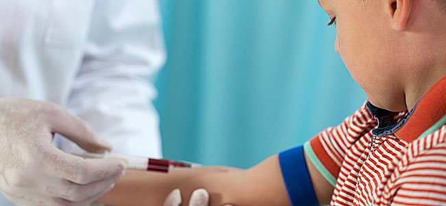Analítica de sangre en los niños. Colesterol alto Analítica de sangre en los niños. Colesterol alto