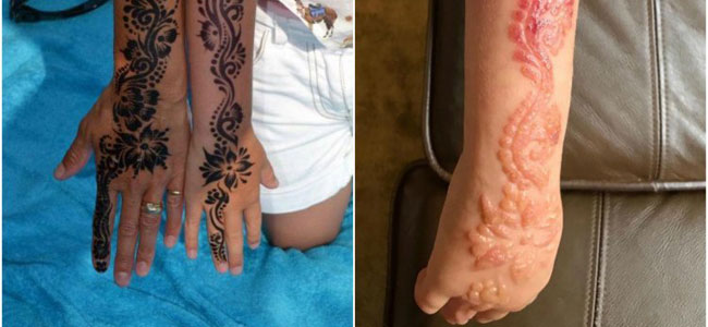 Confirmación George Bernard Inesperado Por qué los tatuajes de henna pueden ser tan peligrosos para los niños